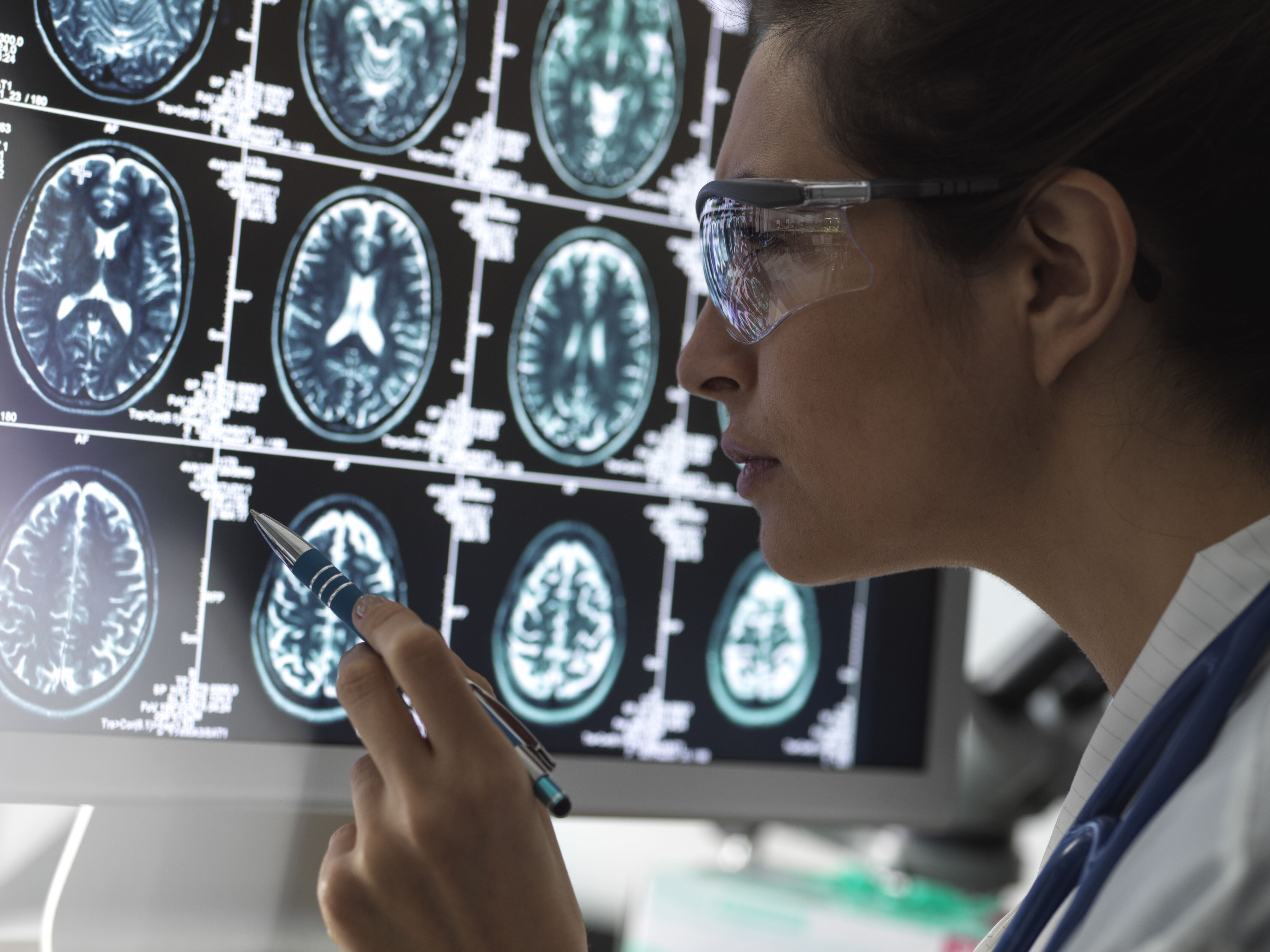 Les neuropathies périphériques chroniques