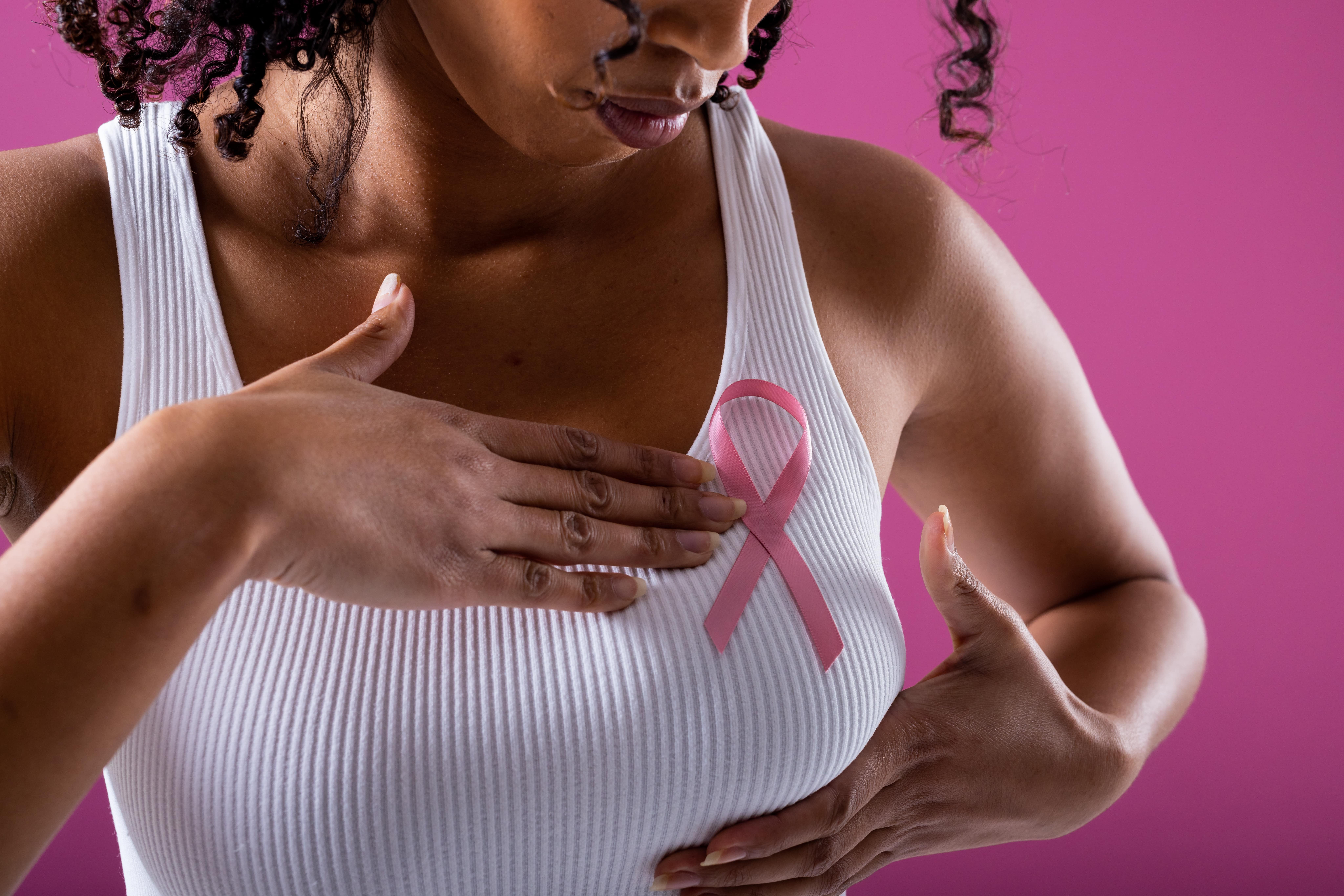 Après une mastectomie : la reconstruction mammaire est-elle obligatoire ?