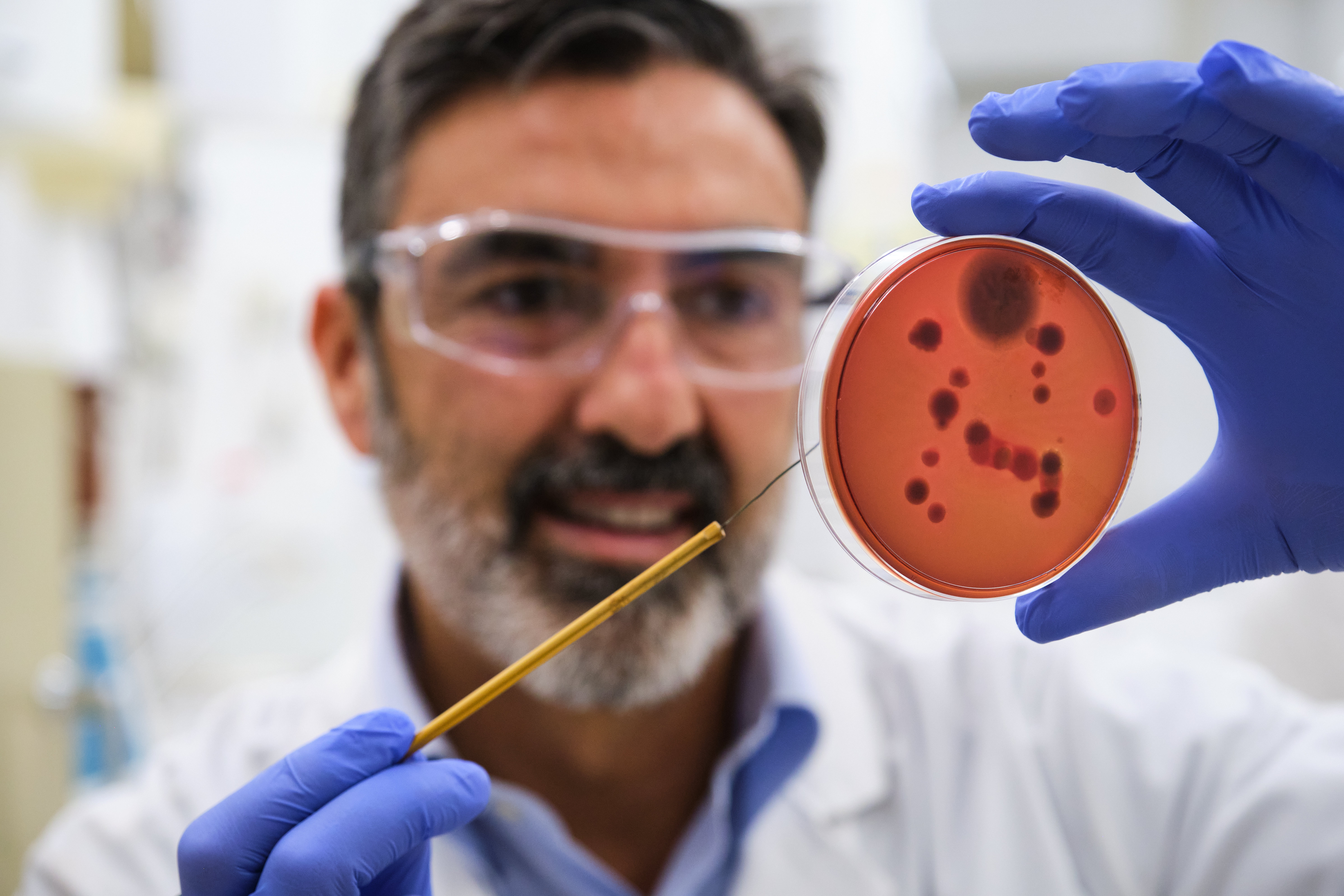 Amibiase : une maladie parasitaire courante