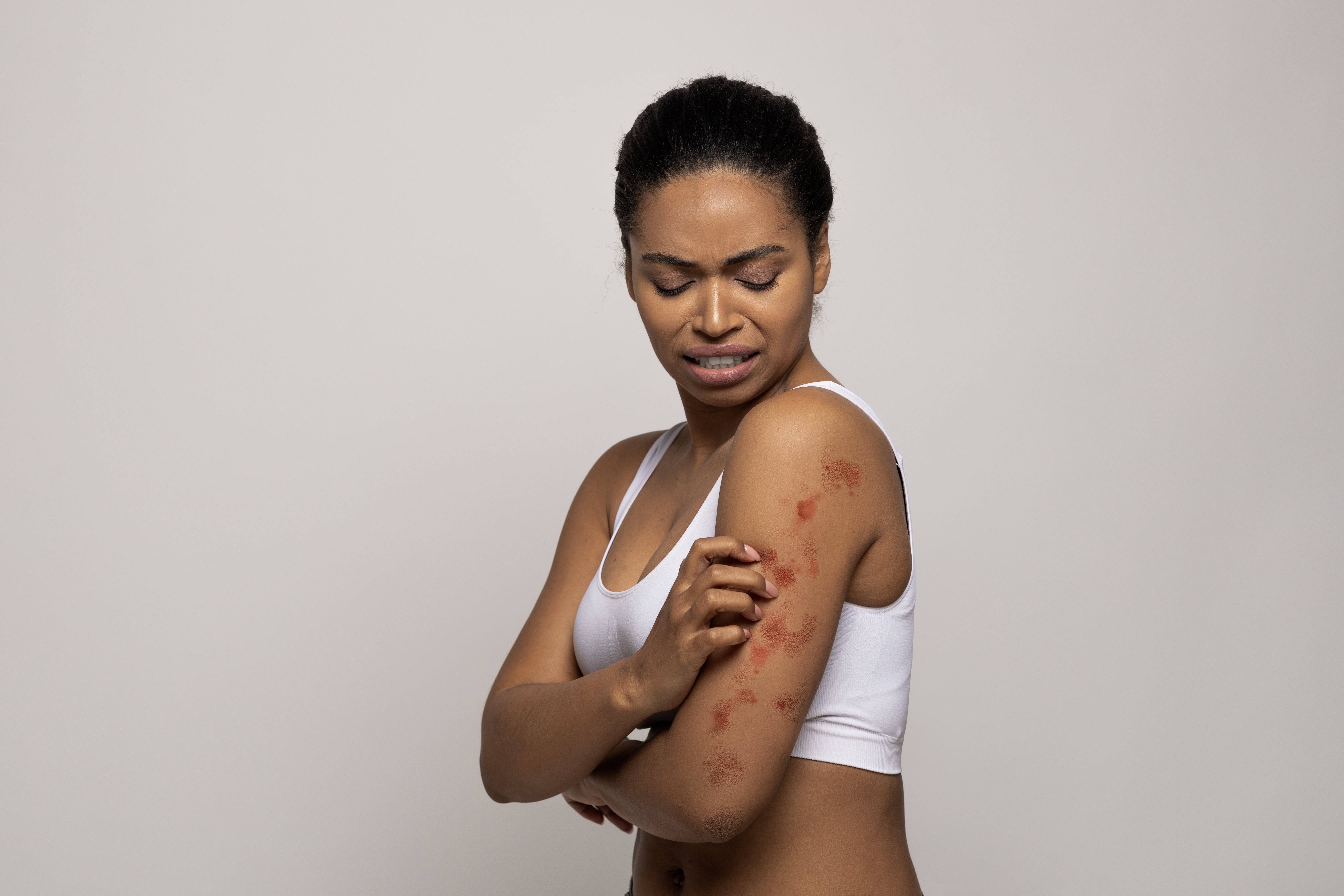 Les Arboviroses : Dengue, Chikungunya, Zika